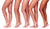 Get Rid of Cellulite on the Thighs